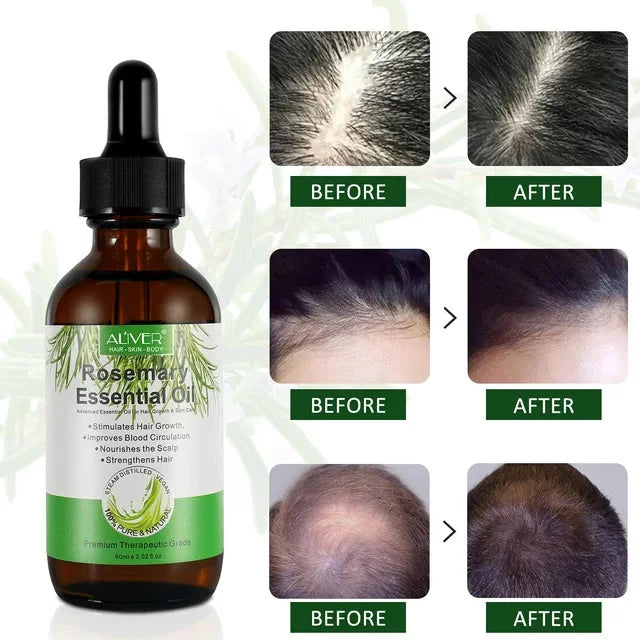 Aliver (2 Pack) Pure Rosemary Essential Oil for Hair Growth Dry Scalp Care - Amado Deals - wholesale and distributors with free shipping in United States