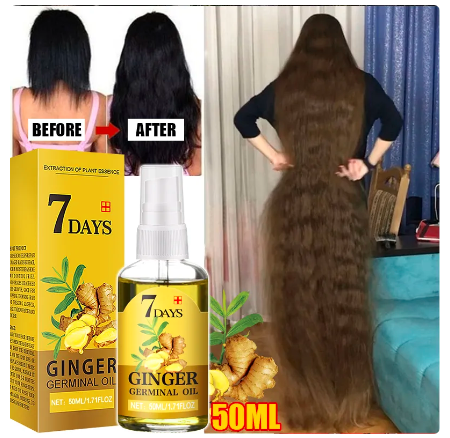 Fast Hair Growth Men Women Ginger Growth Hair Oil Treatment Anti Hair Loss Scalp Treatment Serum Products Beauty Health - Amado Deals - wholesale and distributors with free shipping in United States