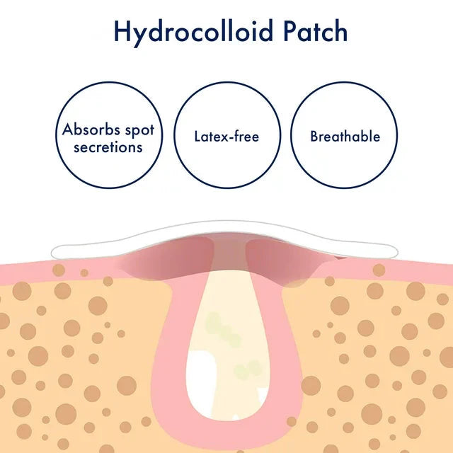 PanOxyl Overnight Spot Patches, Pimple Patch, Clear, 40 Patches - Amado Deals - wholesale and distributors with free shipping in United States